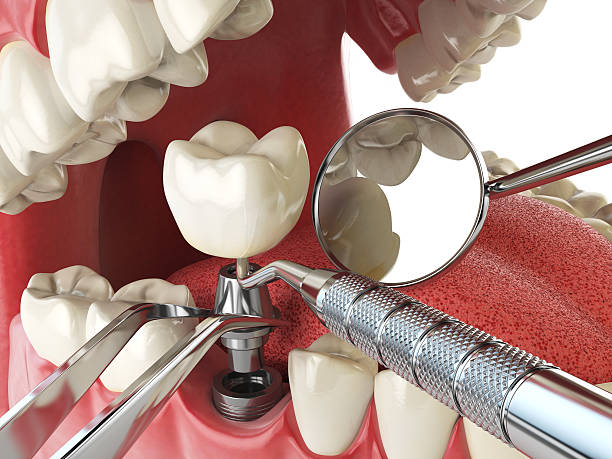 Best Emergency Care for Gum Disease in Rushvle, IL
